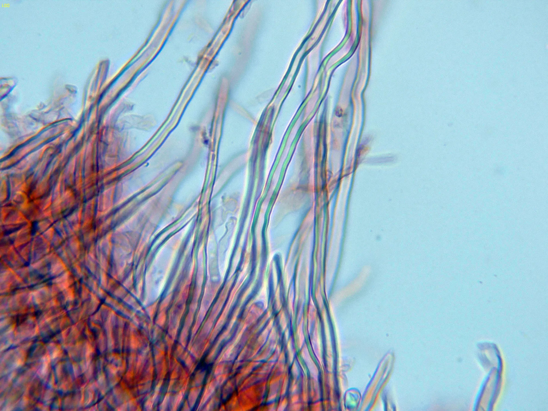 Microscopía de Navisporus floccosus - 11 - Hifas-001